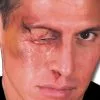 Geschwollenes Auge Wunde -Finster Mode Haus 17995 geschwollenes auge wunde blaue auge wunde unfallopfer wunde zombie auge wunde augentrauma wunde augen wunde swollen eye wound